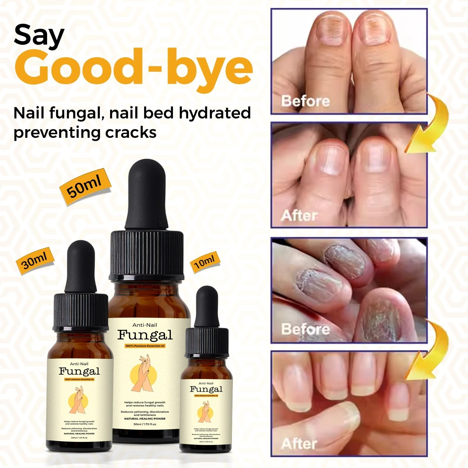 Anti-Nail Fungal Treatment Oil - 10 ml 