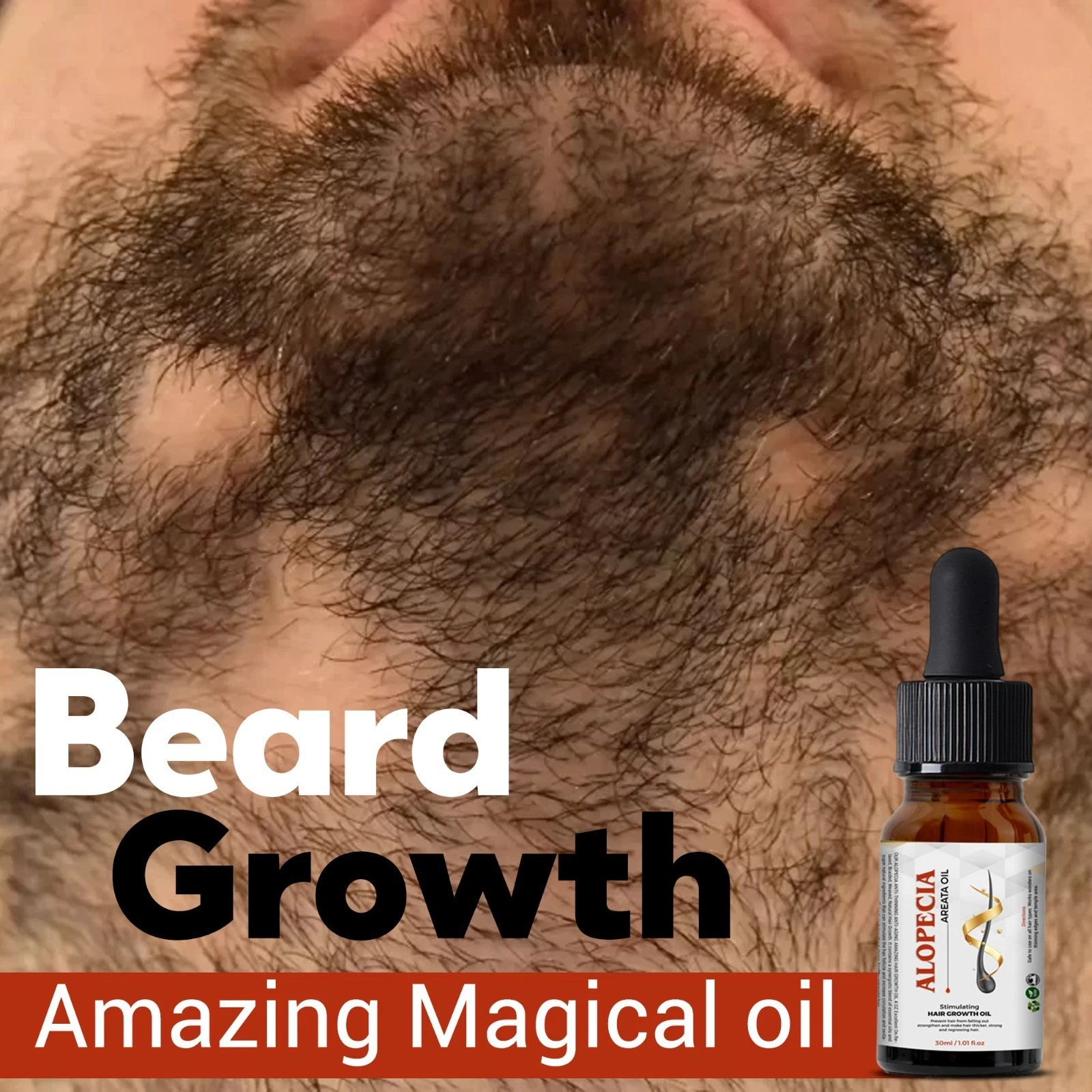 Alopecia Hair Regrowth Treatment Oil - 30 ml