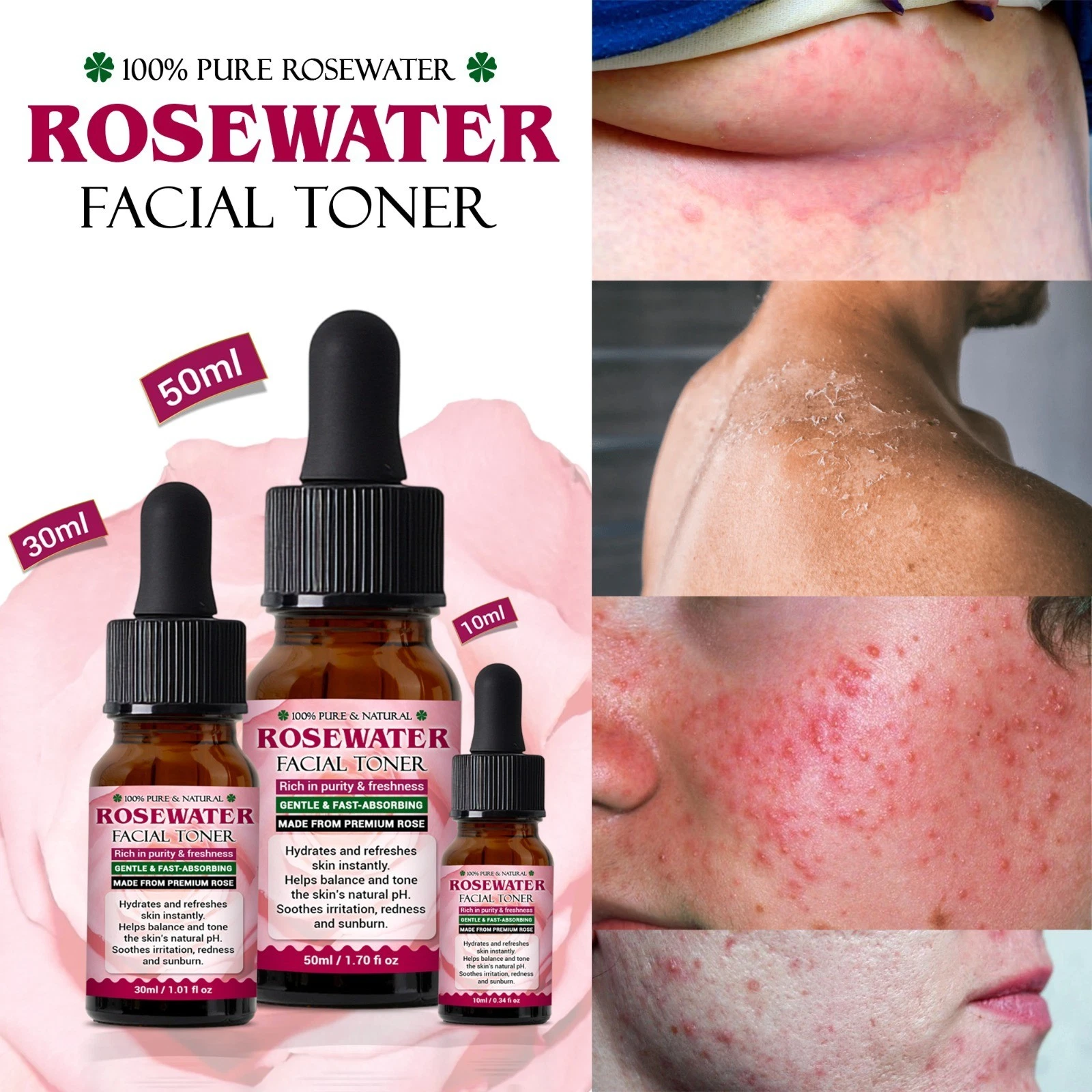 Face toner Non-Alcoholic/ face acne dark spots/100% natural