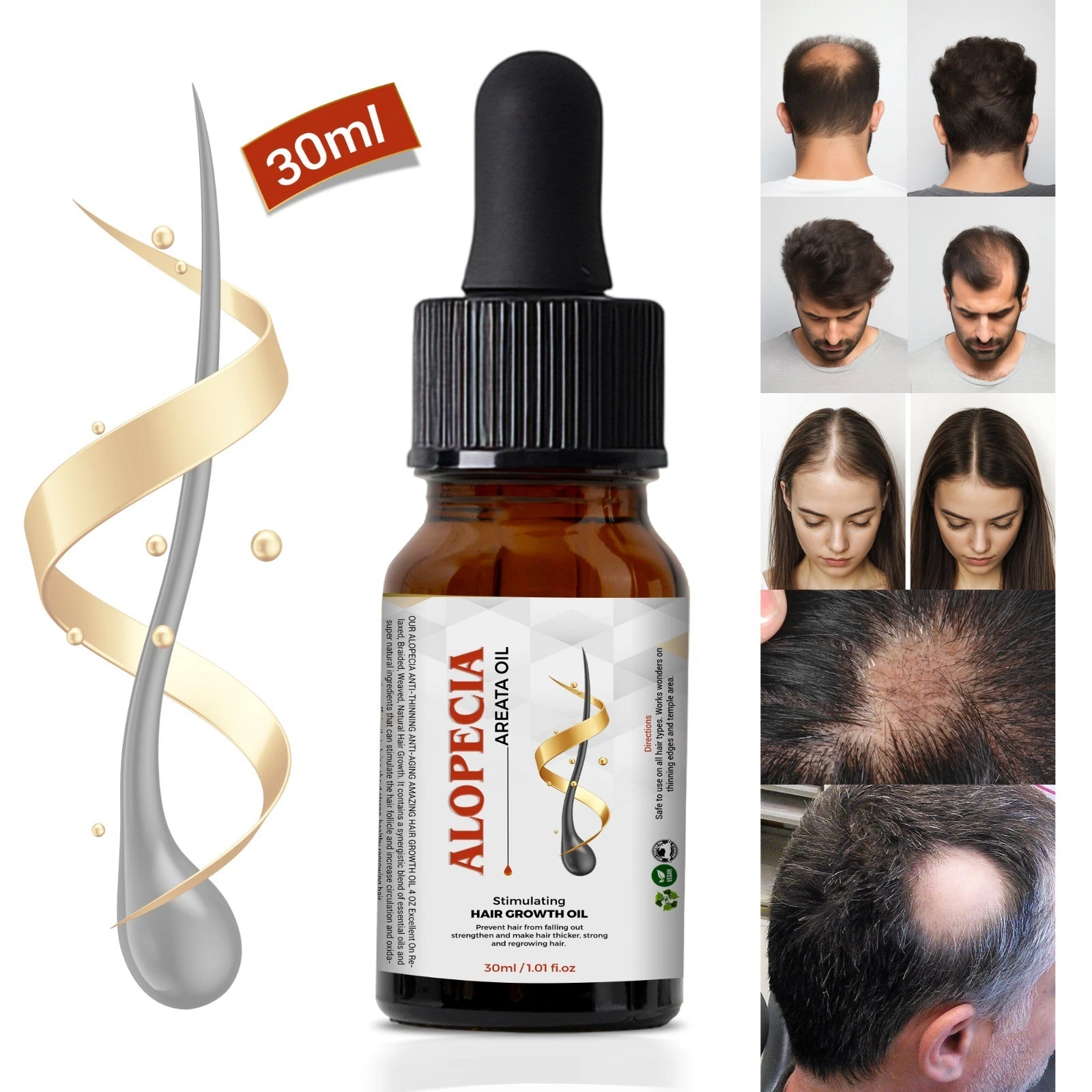 Alopecia Hair Regrowth Treatment Oil - 10 ml