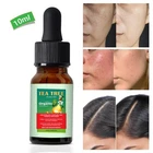 Tea Tree Oil 100% Pure , Therapeutic Grade Essential Oil for Skin & Hair UK - 30ml