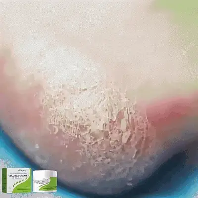 South Moon - 42% Urea Cream (Original)