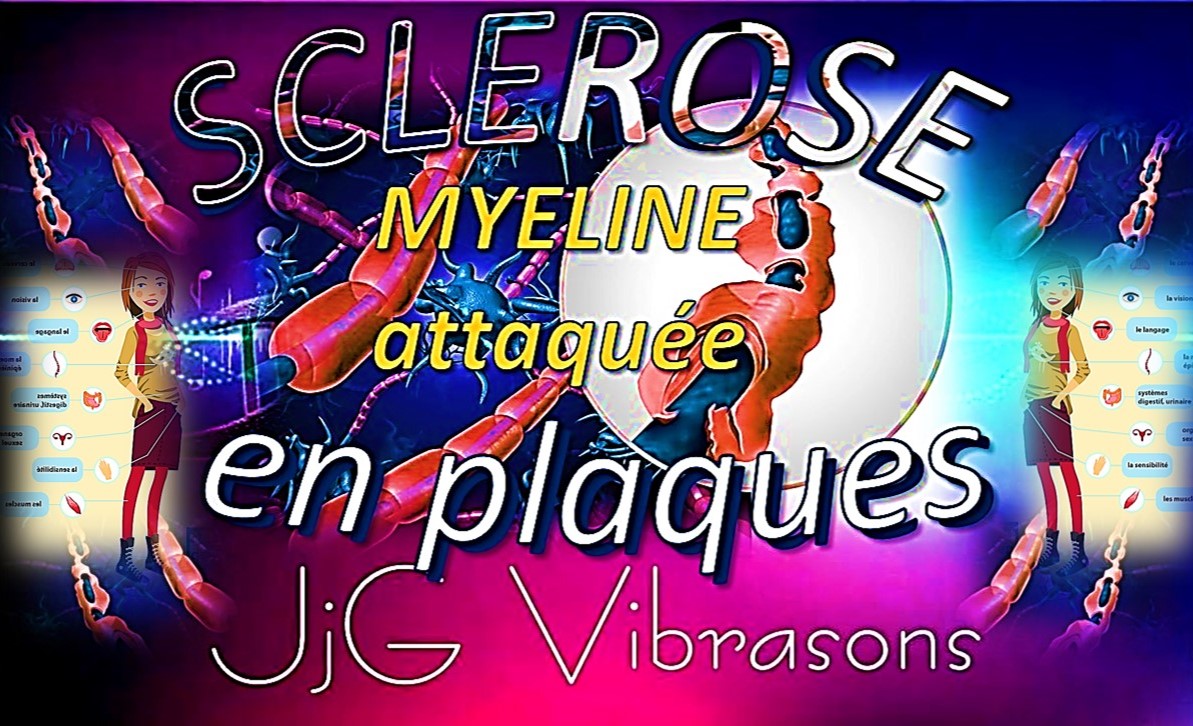 SCLEROSE EN PLAQUES