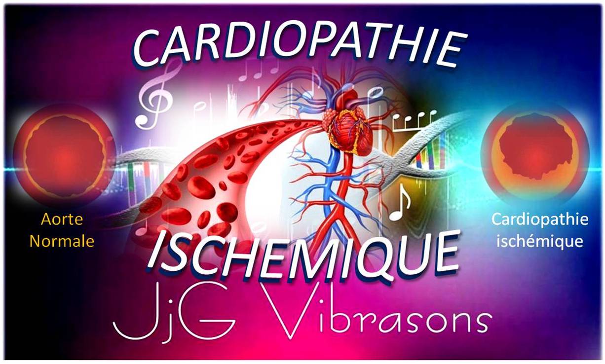 CARDIOPATHIE ISCHEMIQUE