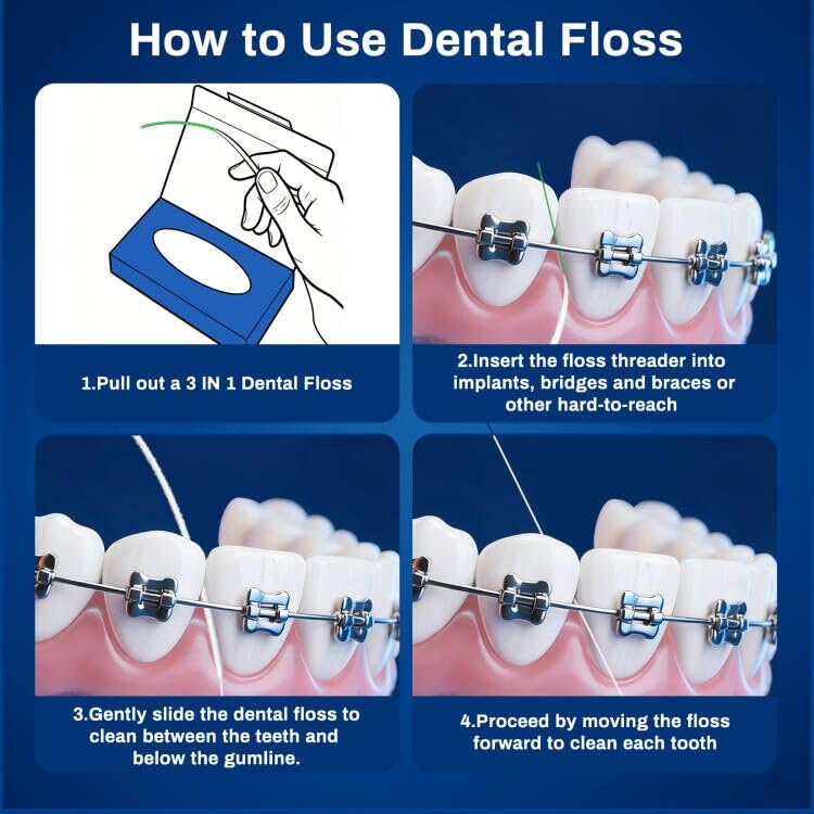 3-in-1 Dental Floss with Threaders for Braces,Bridges,and Crowns - 240 Count Pre-Cut Strands - Spongy Floss Middle & Regular Tail for Orthodontic Oral Care