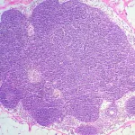 Immune System Slides