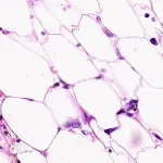 Connective Tissue Slides