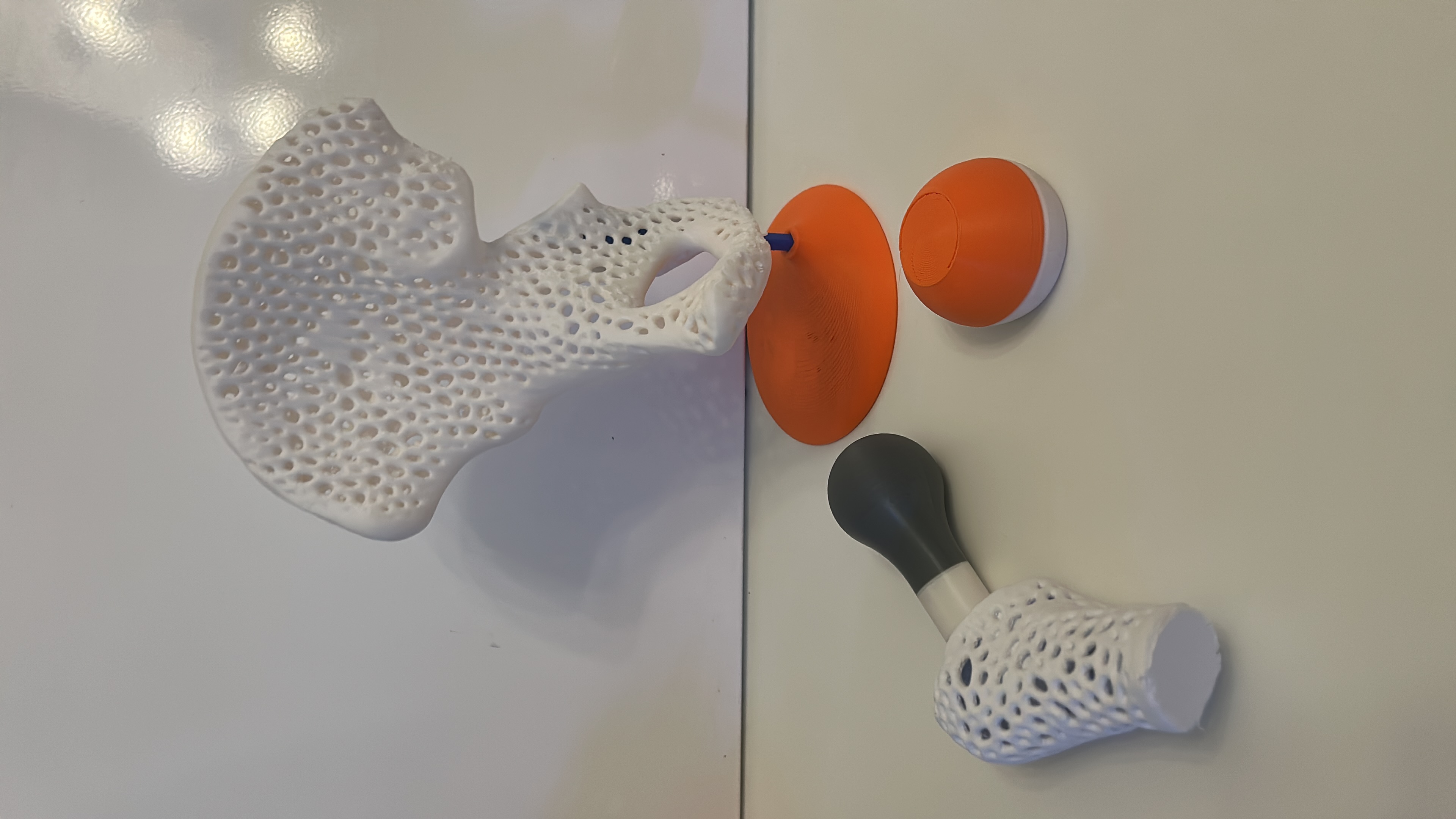 Artroplastica dell'anca - Modello osseo e protesi