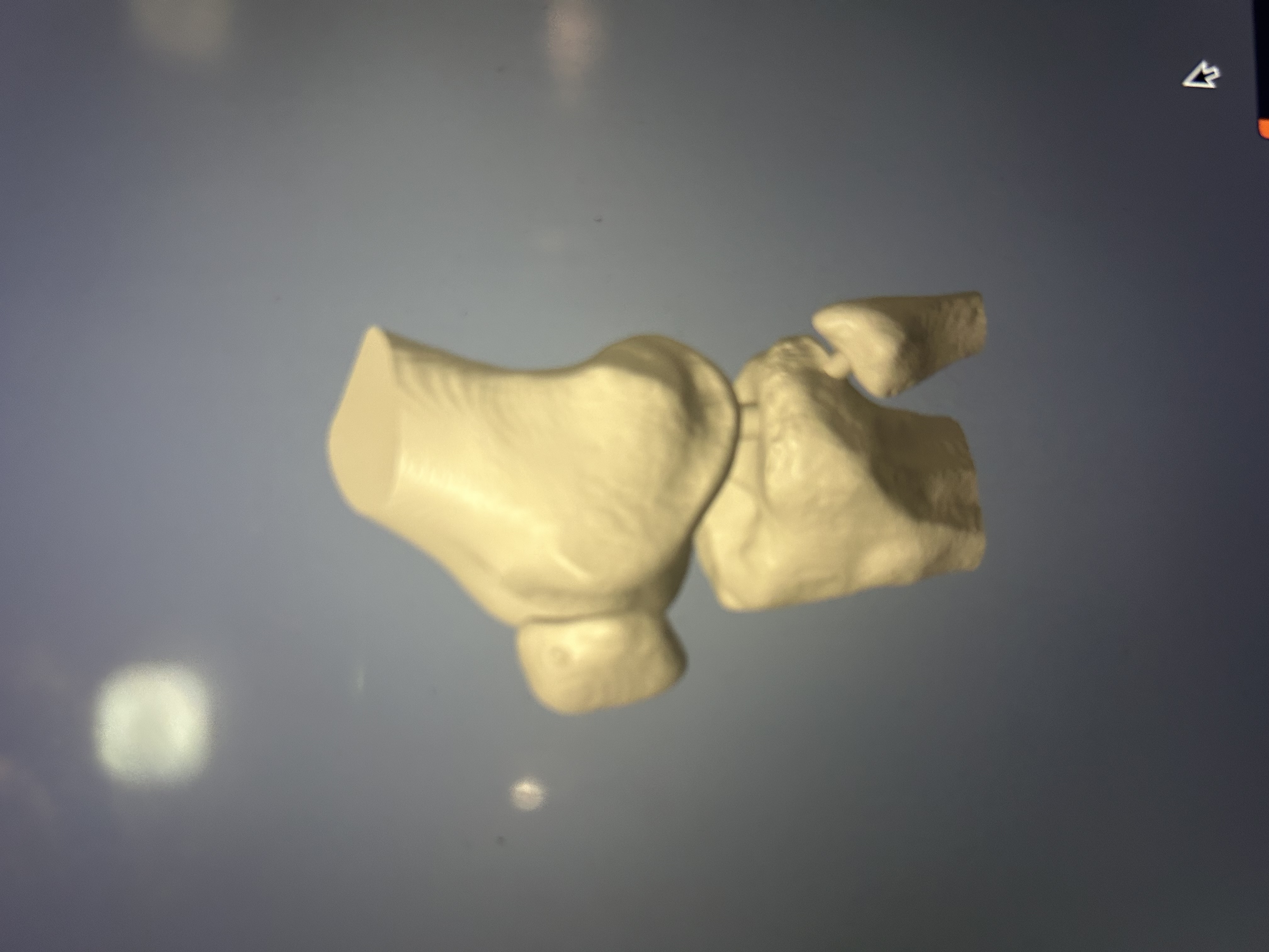 Modello di osso del ginocchio umano stampato in 3D