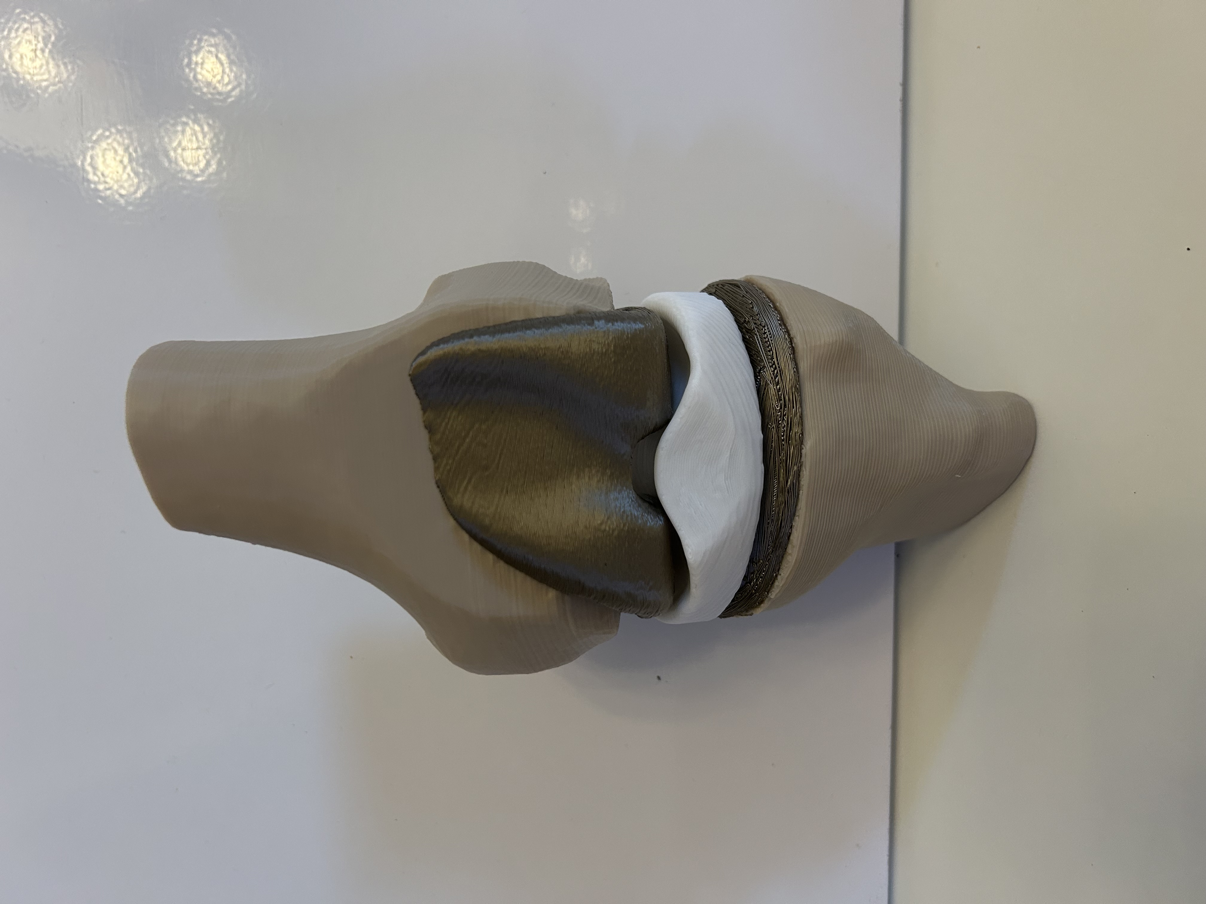 Modello 3D di protesi totale del ginocchio umano