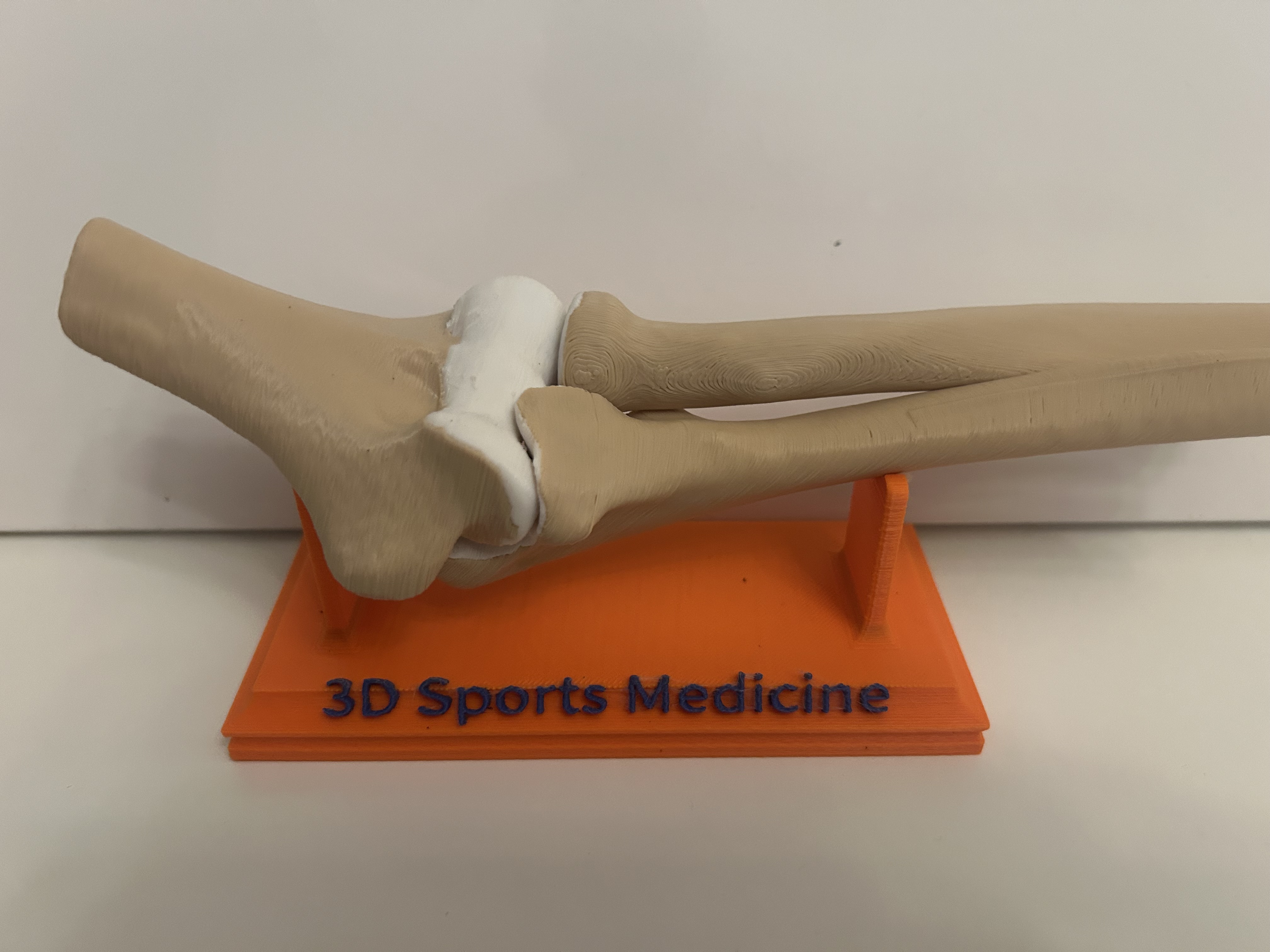 Modello di articolazione del gomito stampato in 3D