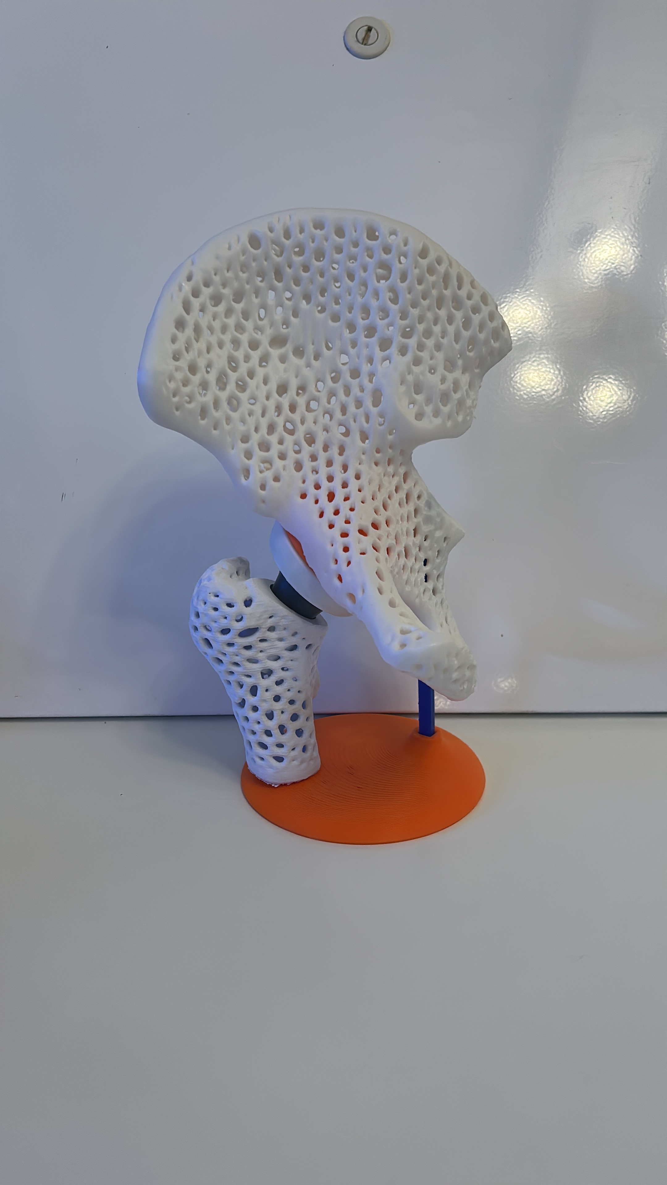 Artroplastica dell'anca - Modello osseo e protesi