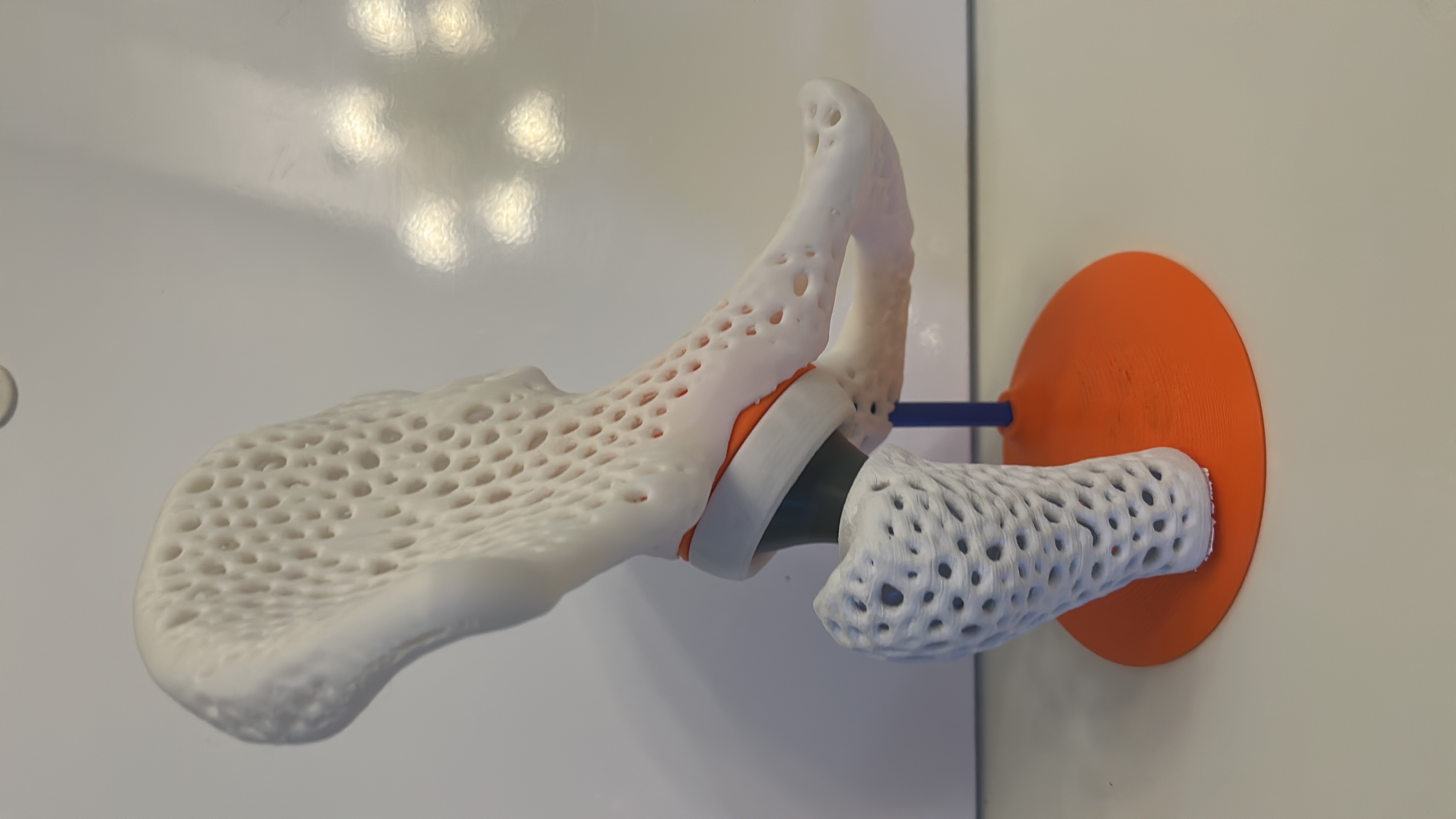 Artroplastica dell'anca - Modello osseo e protesi