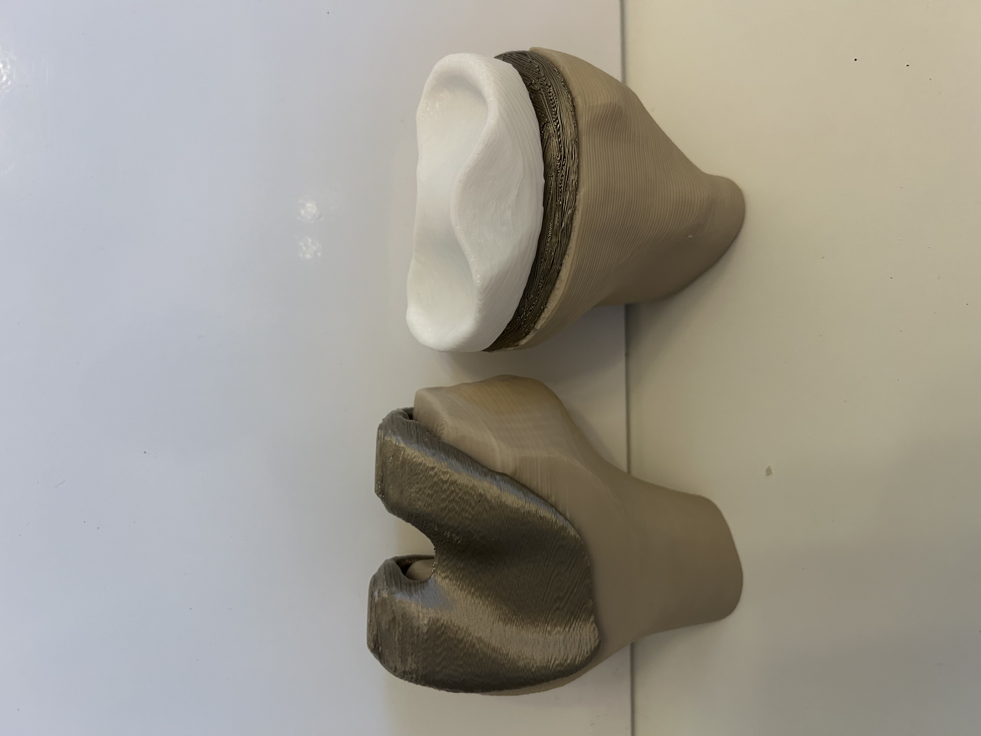 Modello 3D di protesi totale del ginocchio umano