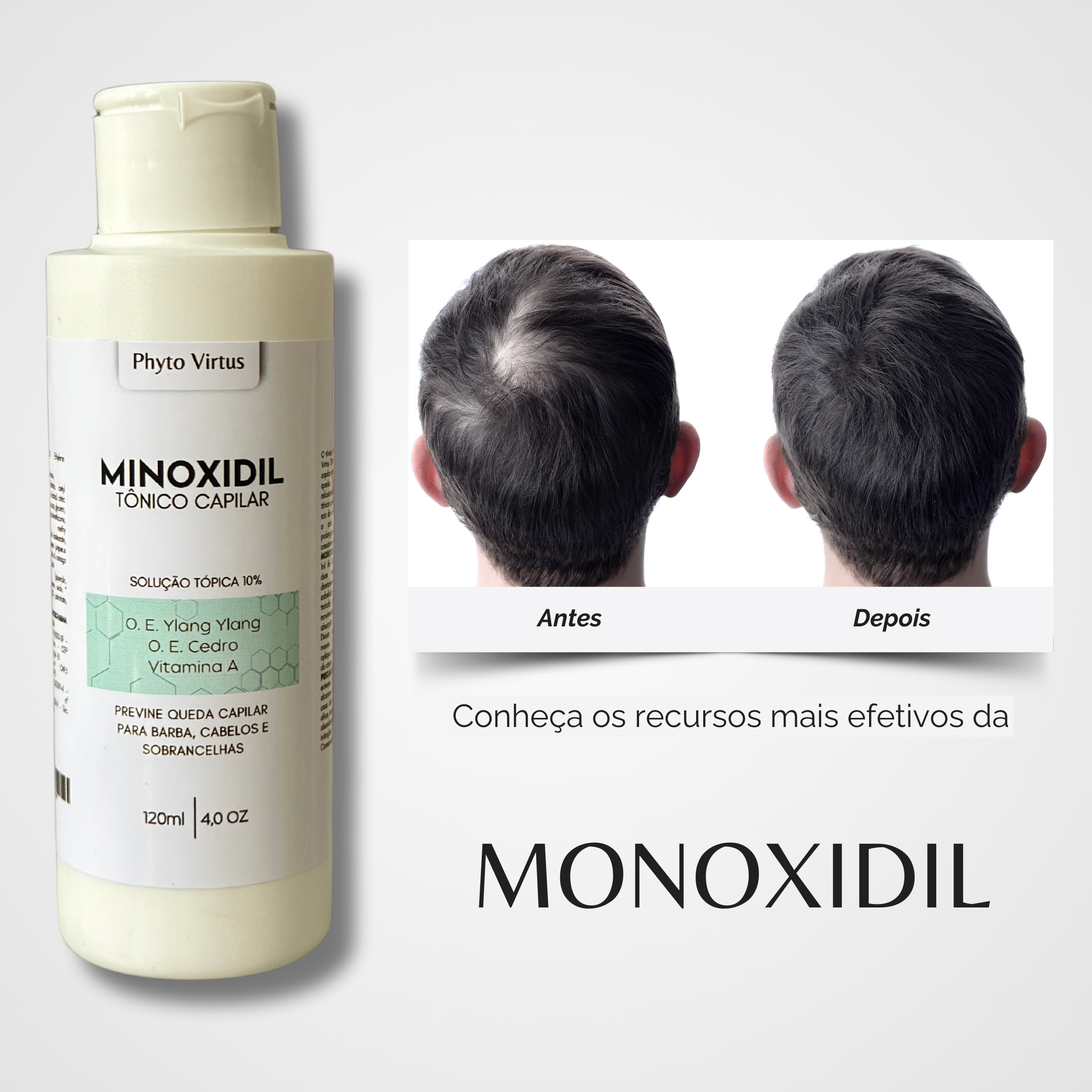 TÔNICO MINOXIDIL 120ml