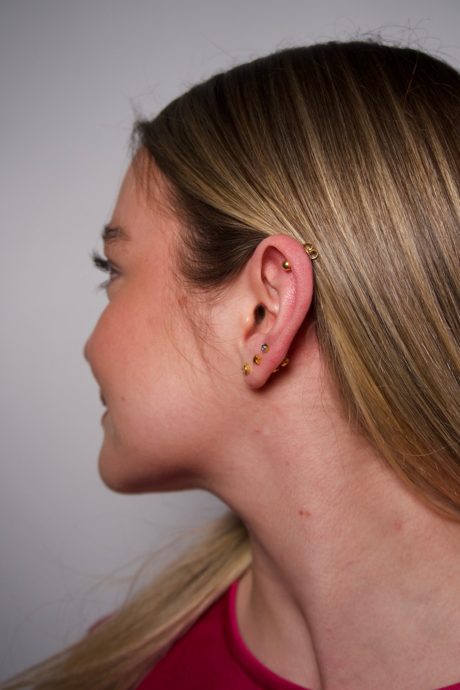 Cita de Perforación