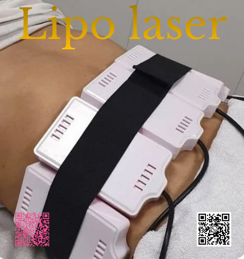 Lipo láser corporal
