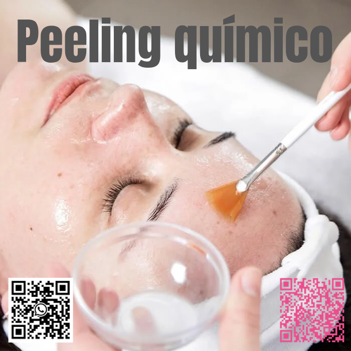 Peelings quimico 
