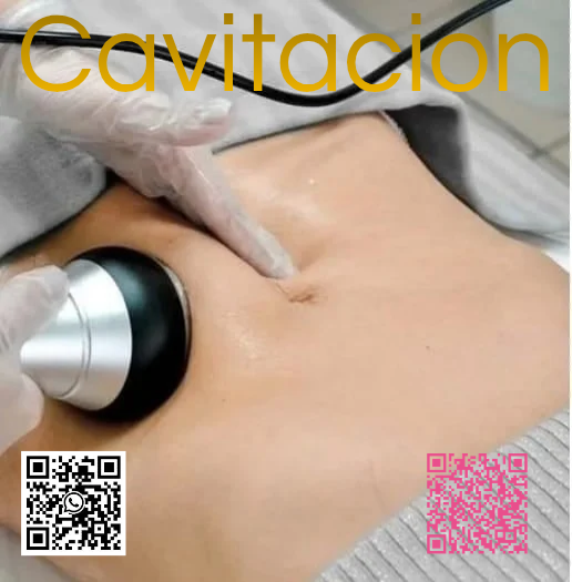 Cavitación Corporal