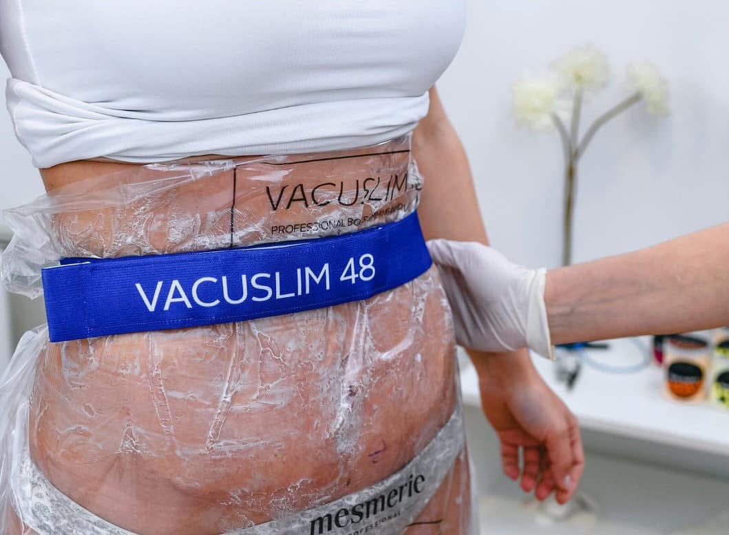 Vacuslim48 (vakuuminė anti-celiulitinė ir liekninamoji procedūra)