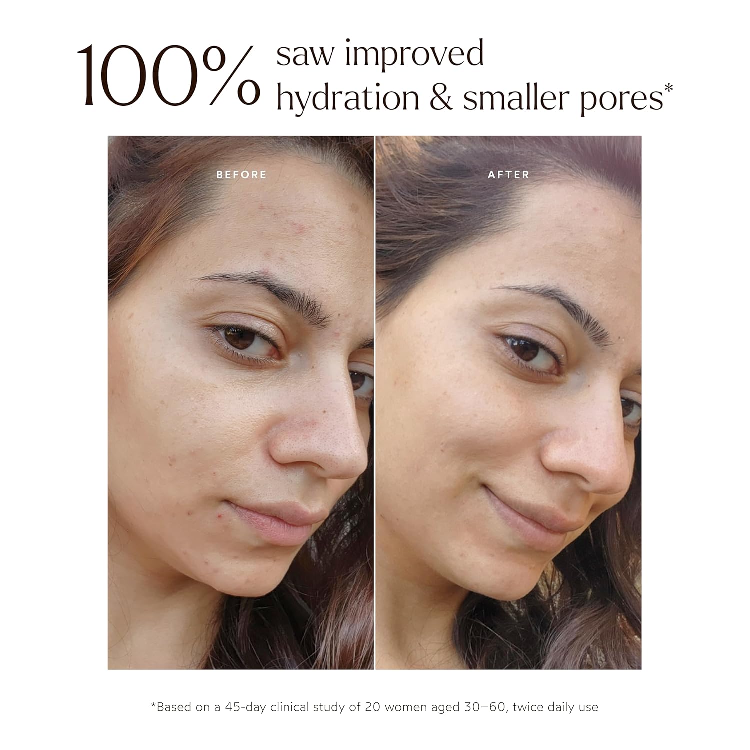 True Botanicals Renew Pure Radiance Oil | All Skin Types | Anti-Aging Face Oil