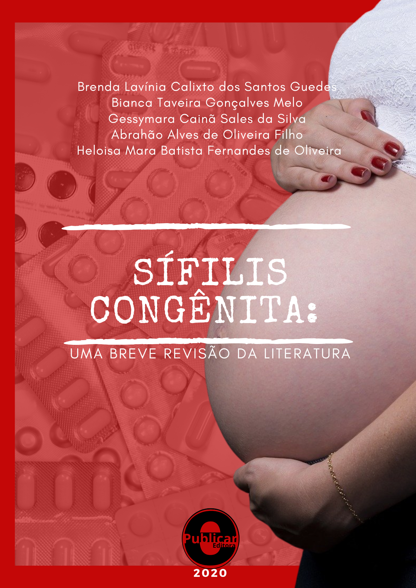 Sífilis congênita: Uma breve revisão da literatura