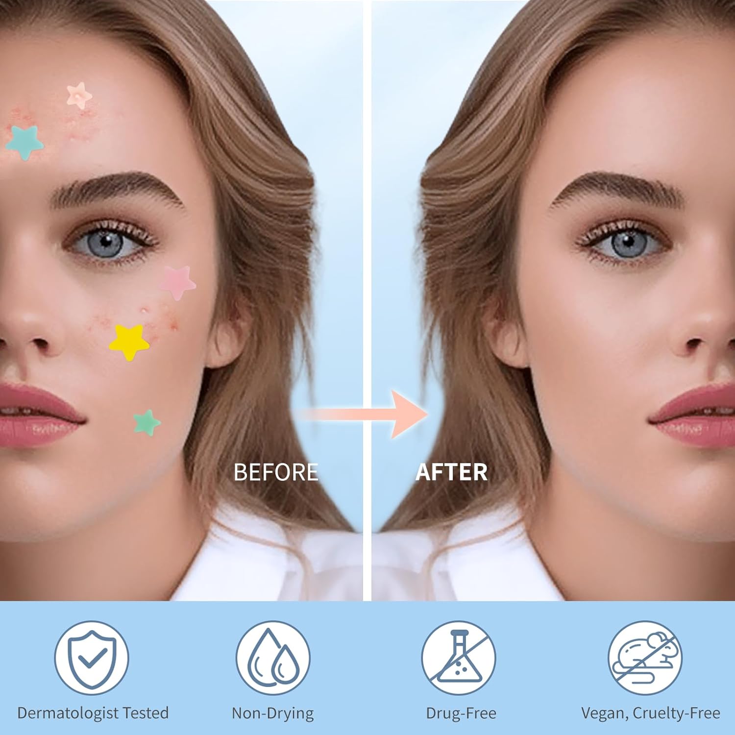 Pimple Patches for Face, Hydrocolloid Acne Patches