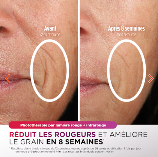 Masque LED LuxeLight