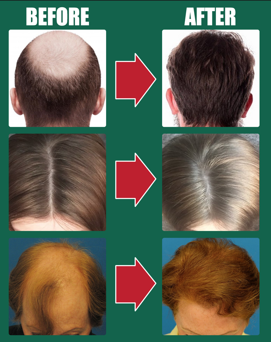 Mint Long Hair Spray Moisturizing Moisturizing Strong Hair Prevents Hair Loss Nourishing Scalp Care Liquid