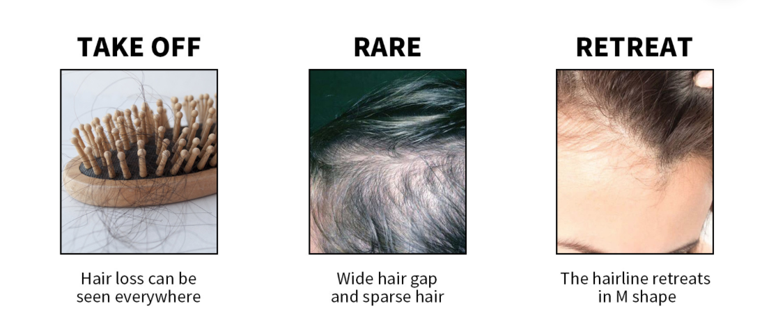 Salp hair nourishing essence hair growth massage scalp hair nourishing