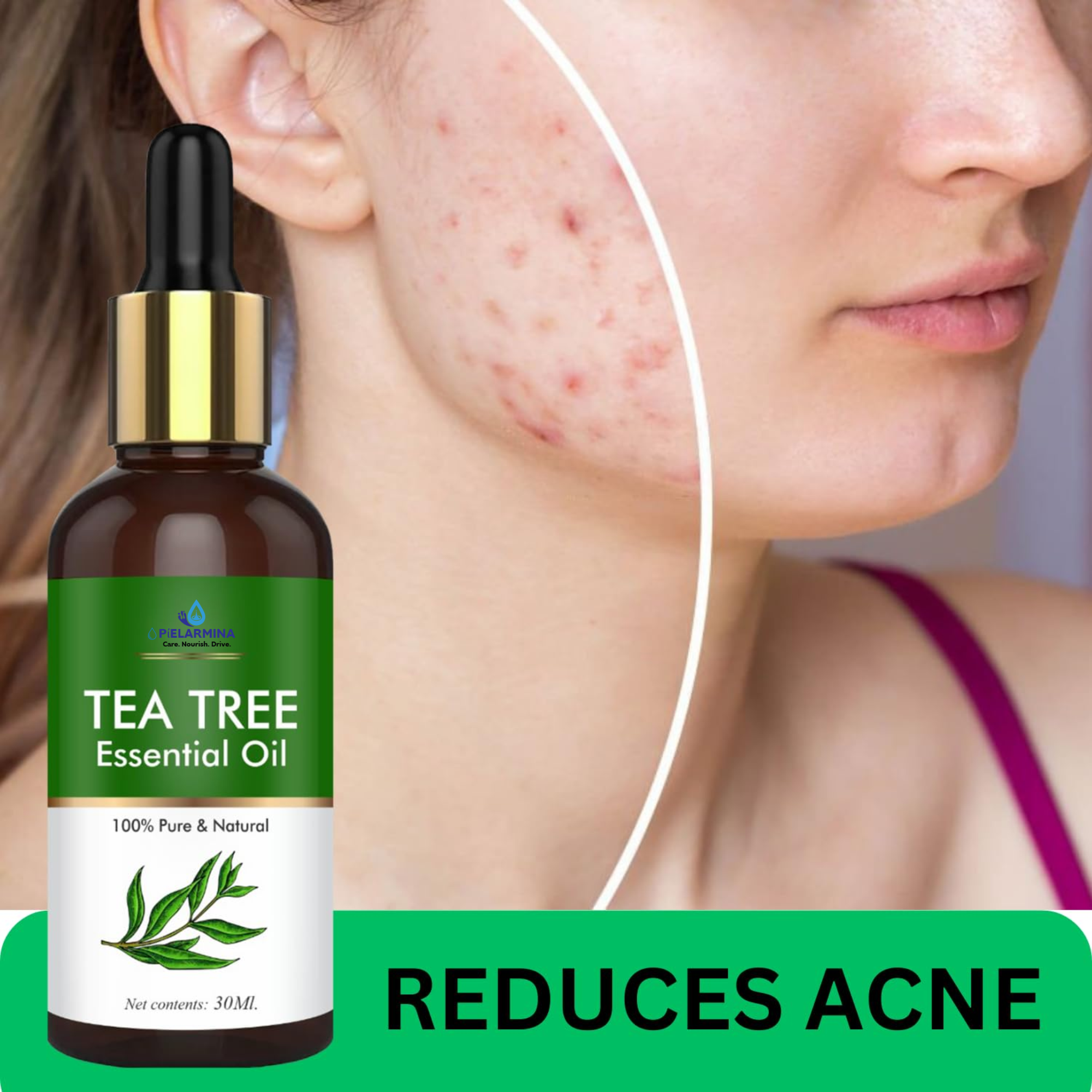 PÍELARMINA Tea Tree Essential Oil For Hair, Skin & Face Acne Care | Promote Hair Growth | Aromatherapy | Women & Men | 30 Ml (Pack of 1)