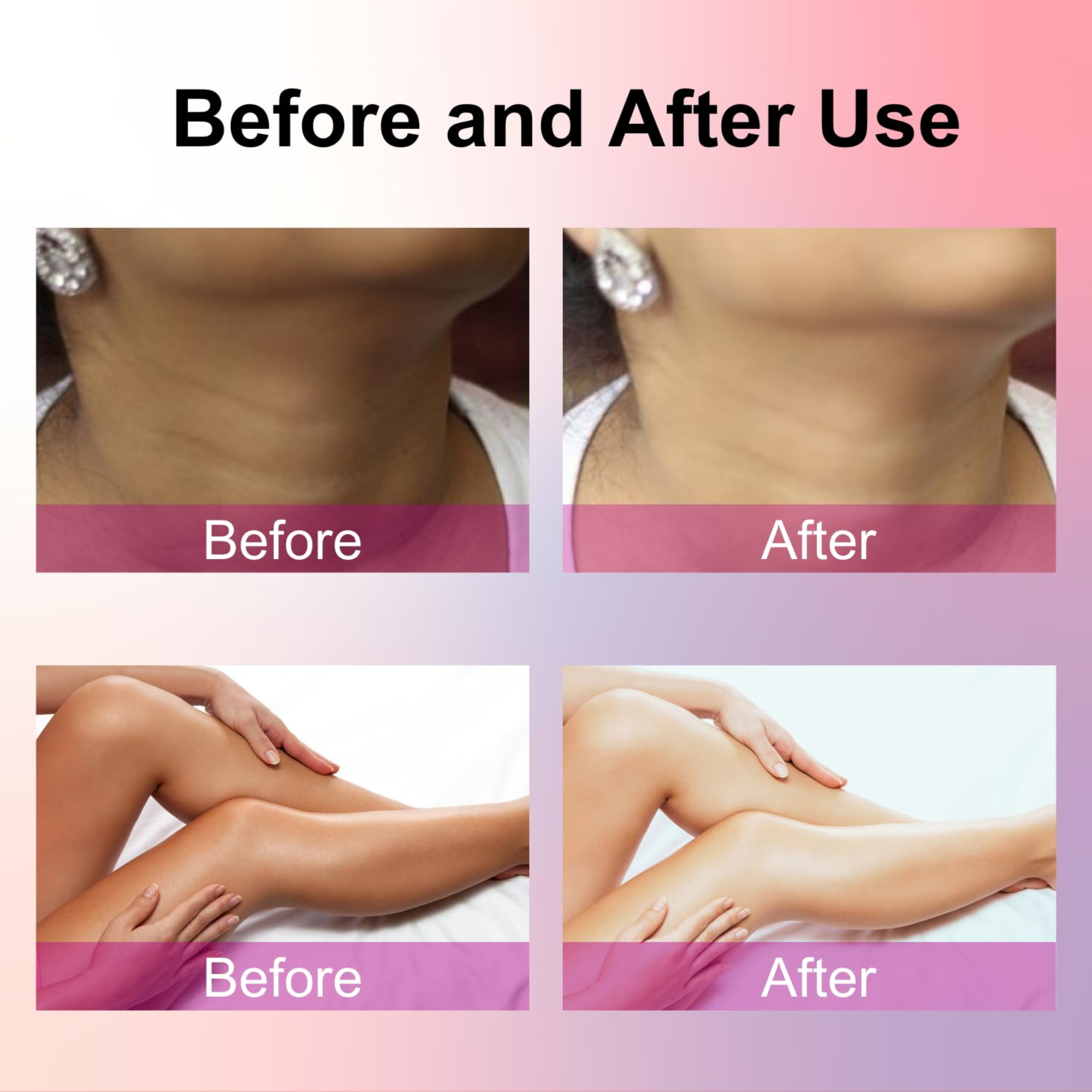 PÍELARMINA Body & Skin Whitening Serum, Skin Brightening Serum For Underarms, Face, Knees, Elbows For Women & Men 30 ml (Pack of 1)