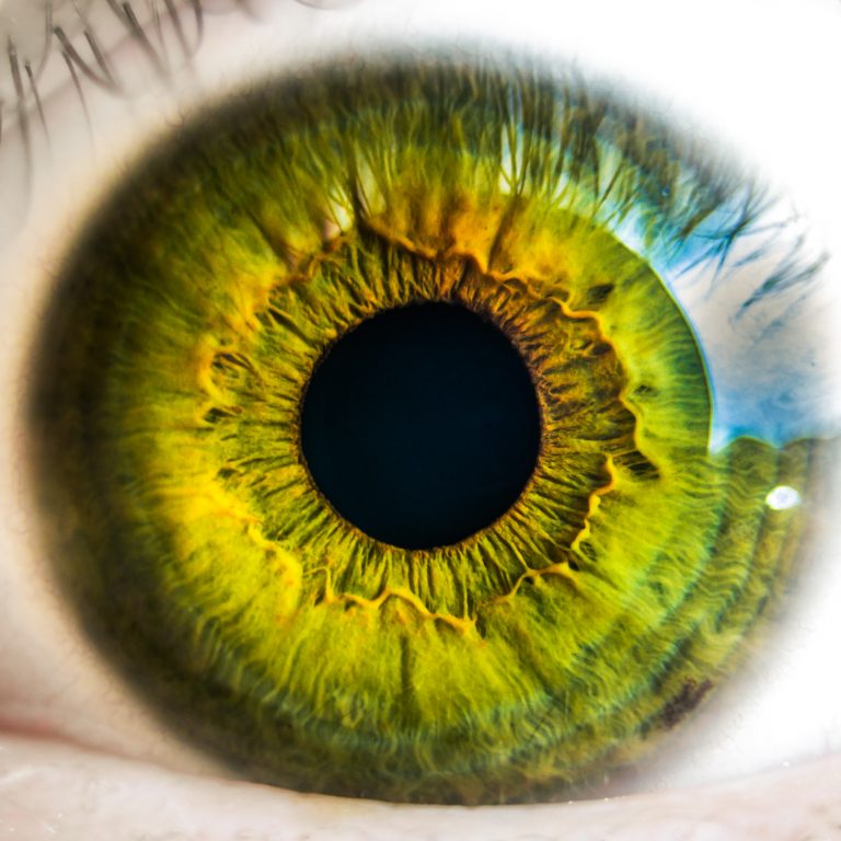 Iridology Assessment