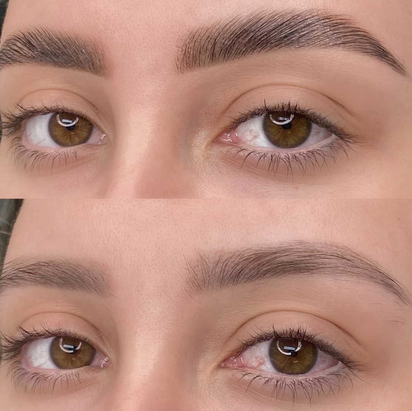 BROW LIFT & BROW SHAPING