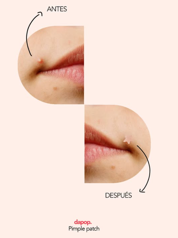  ✨Pimple patch✨