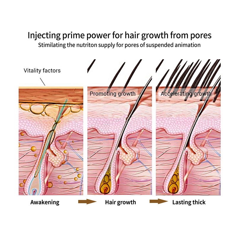 Spray para el crecimiento del cabello