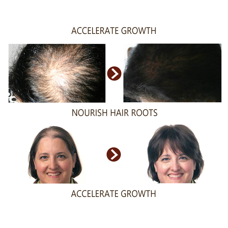 Spray para el crecimiento del cabello