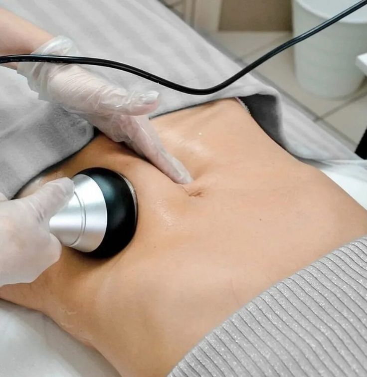 Cavitación (5 sesiones)