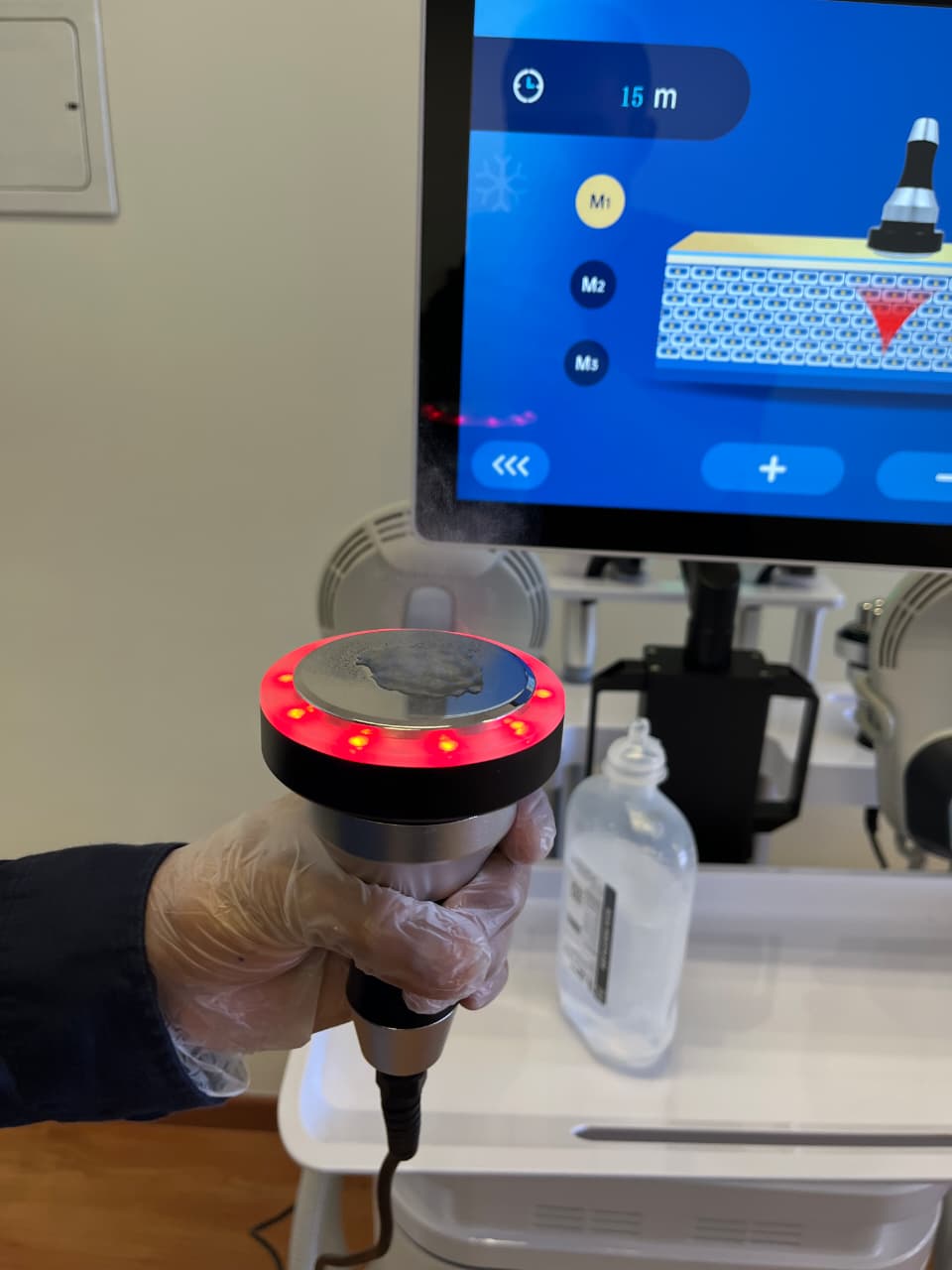 Cavitación (5 sesiones)