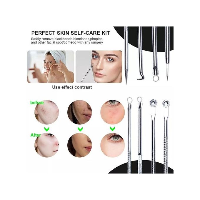 Kit de 4 aiguilles en acier inoxydable pour l'extraction de l'acné du visage