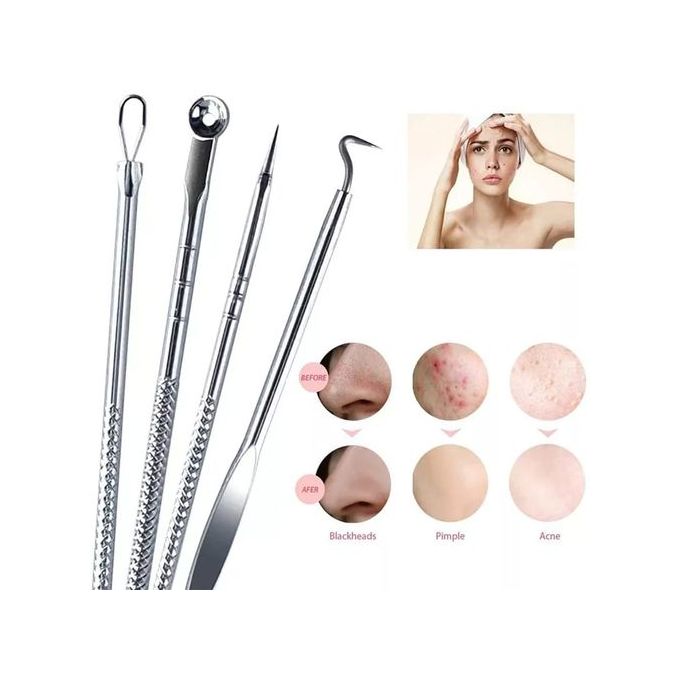 Kit de 4 aiguilles en acier inoxydable pour l'extraction de l'acné du visage