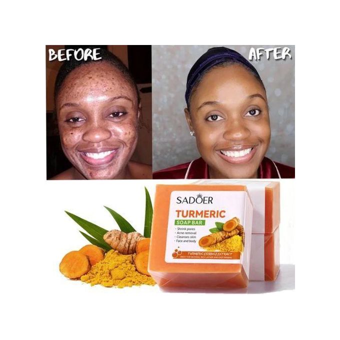 Savon solide au curcuma pour le visage et le corps, anti-taches et éclaircissant - 100 g