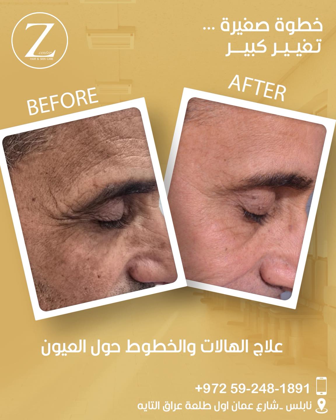 Z Clinic Cosmetic Procedure