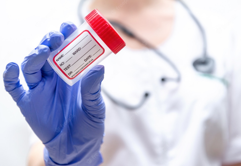 Mycobacterium tuberculosis (Xpert MTB/RIF Ultra -10) DETECCIÓN