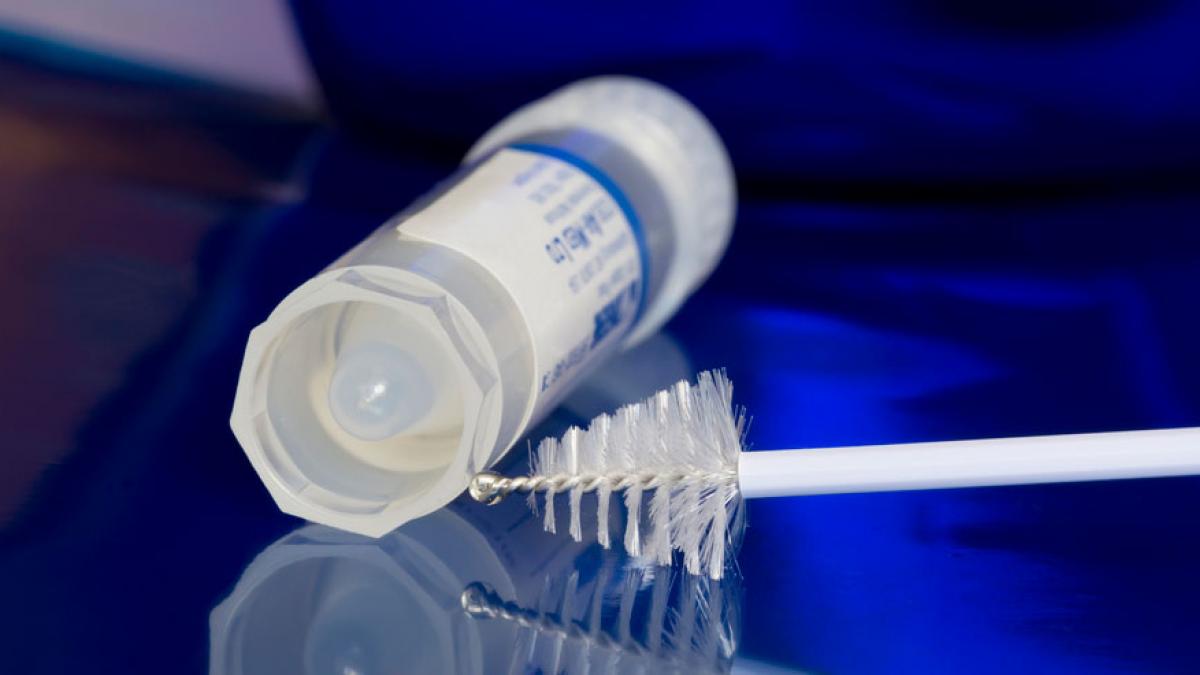 Virus de Papiloma Humano (35 genotipos) DETECCIÓN