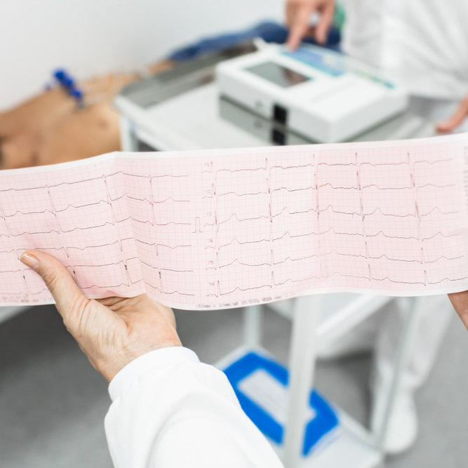 Electrocardiograma en reposo con interpretación médica