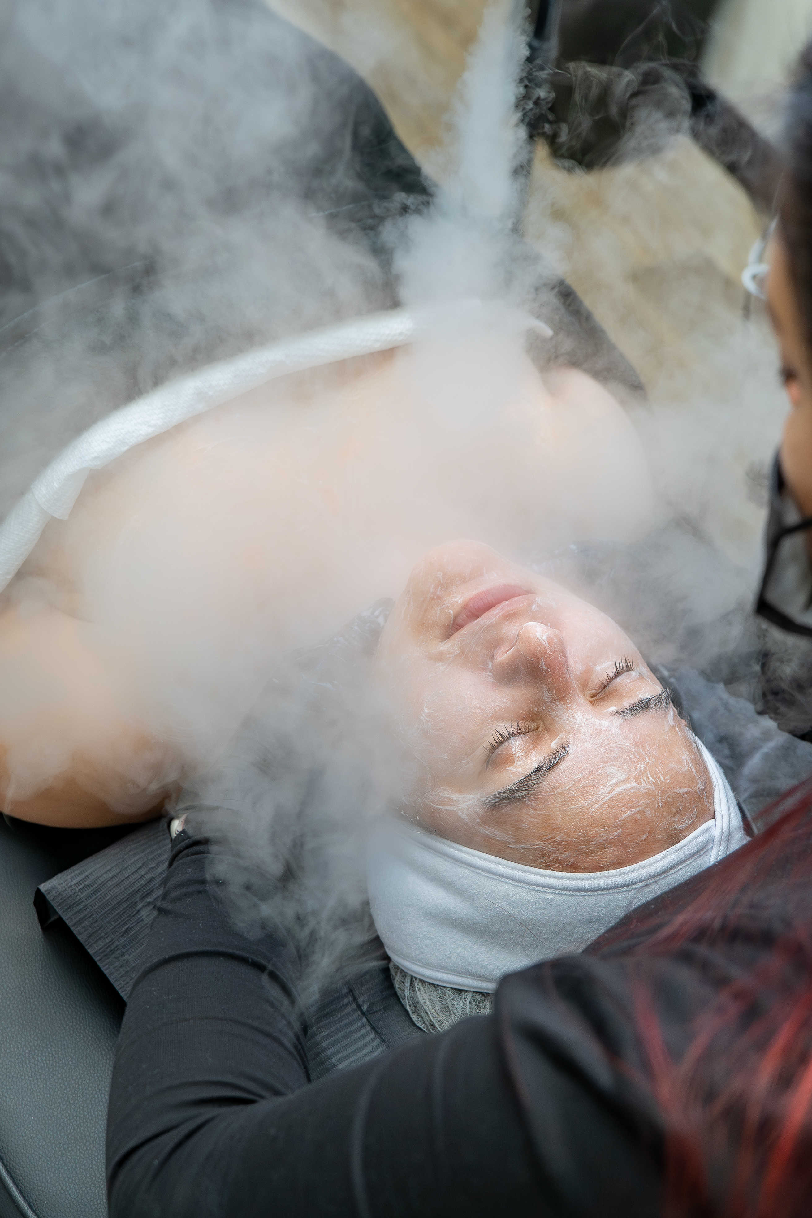 Facial Microdermabrasion 🌟$120