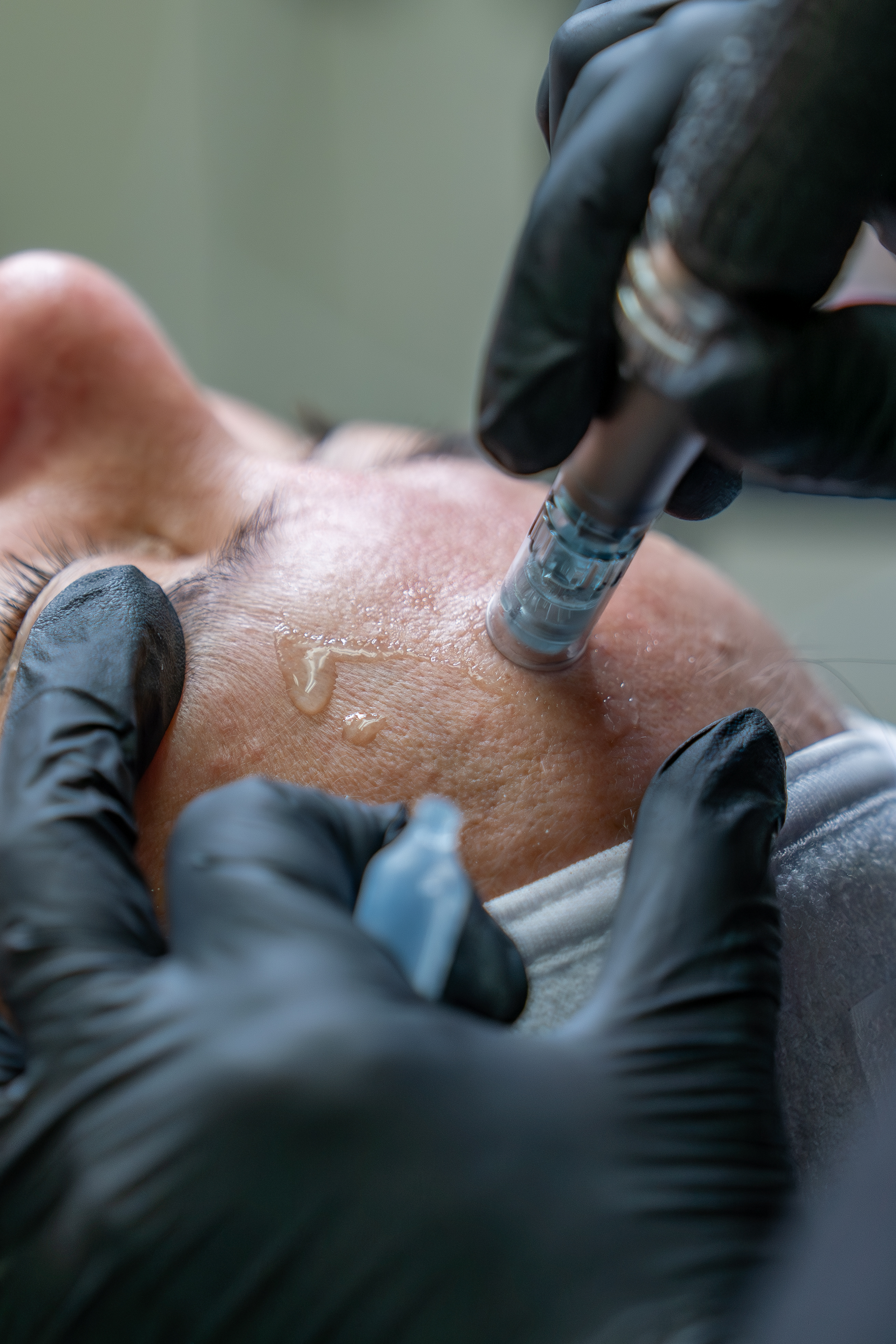 Revitalize your skin from the inside with the power of salmon DNA 