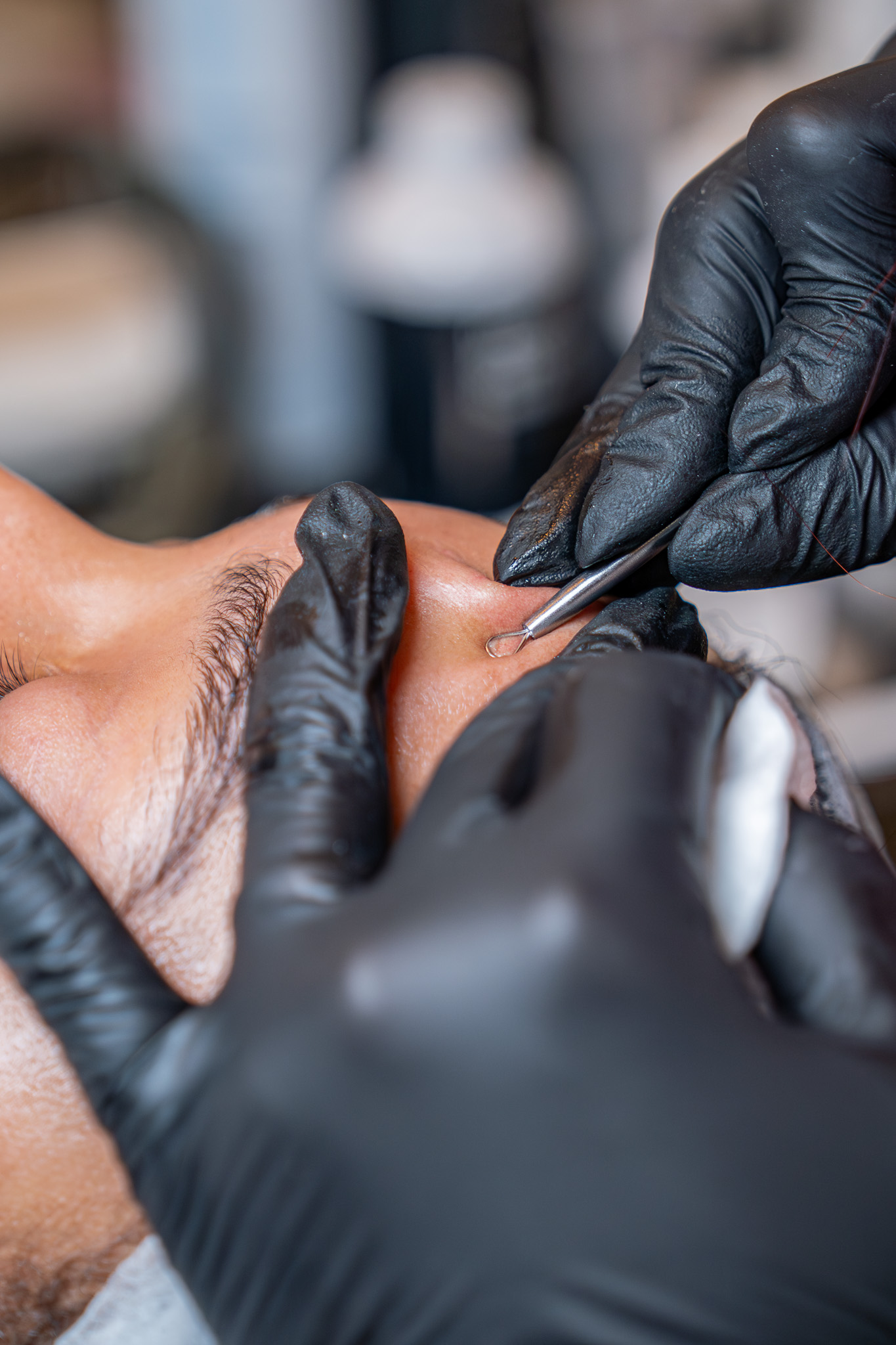 HydraFacial, Dermaplaning & Peels