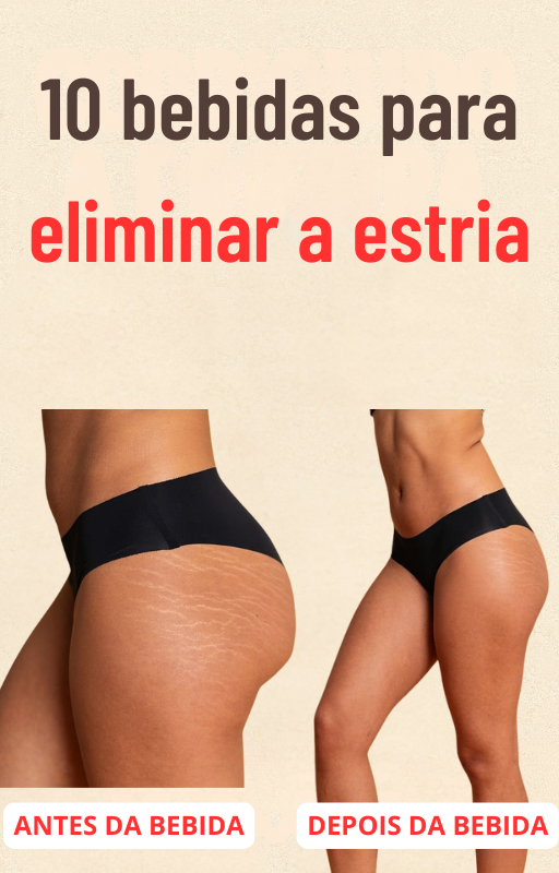 E-BOOK 10 BEBIDAS PARA ELIMINAR A ESTRIA